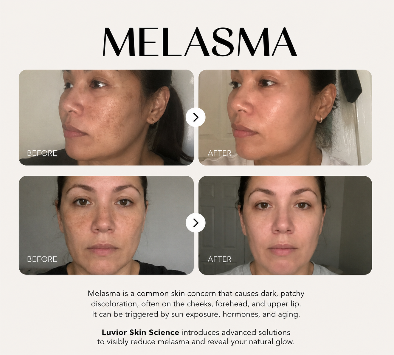 Luvior™ Dark Spot Corrector Serum