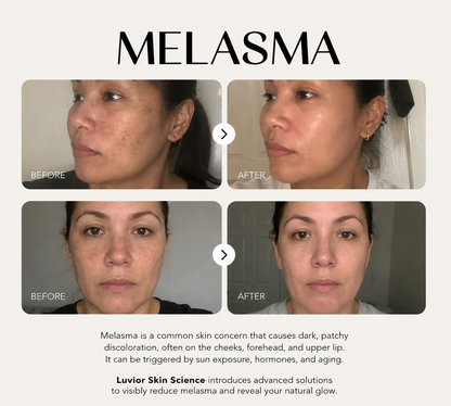 Luvior™ Dark Spot Corrector Serum