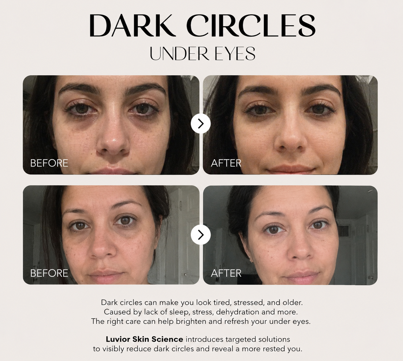 Luvior™ Dark Spot Corrector Serum