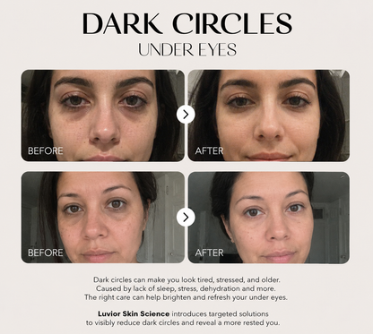 Luvior™ Dark Spot Corrector Serum