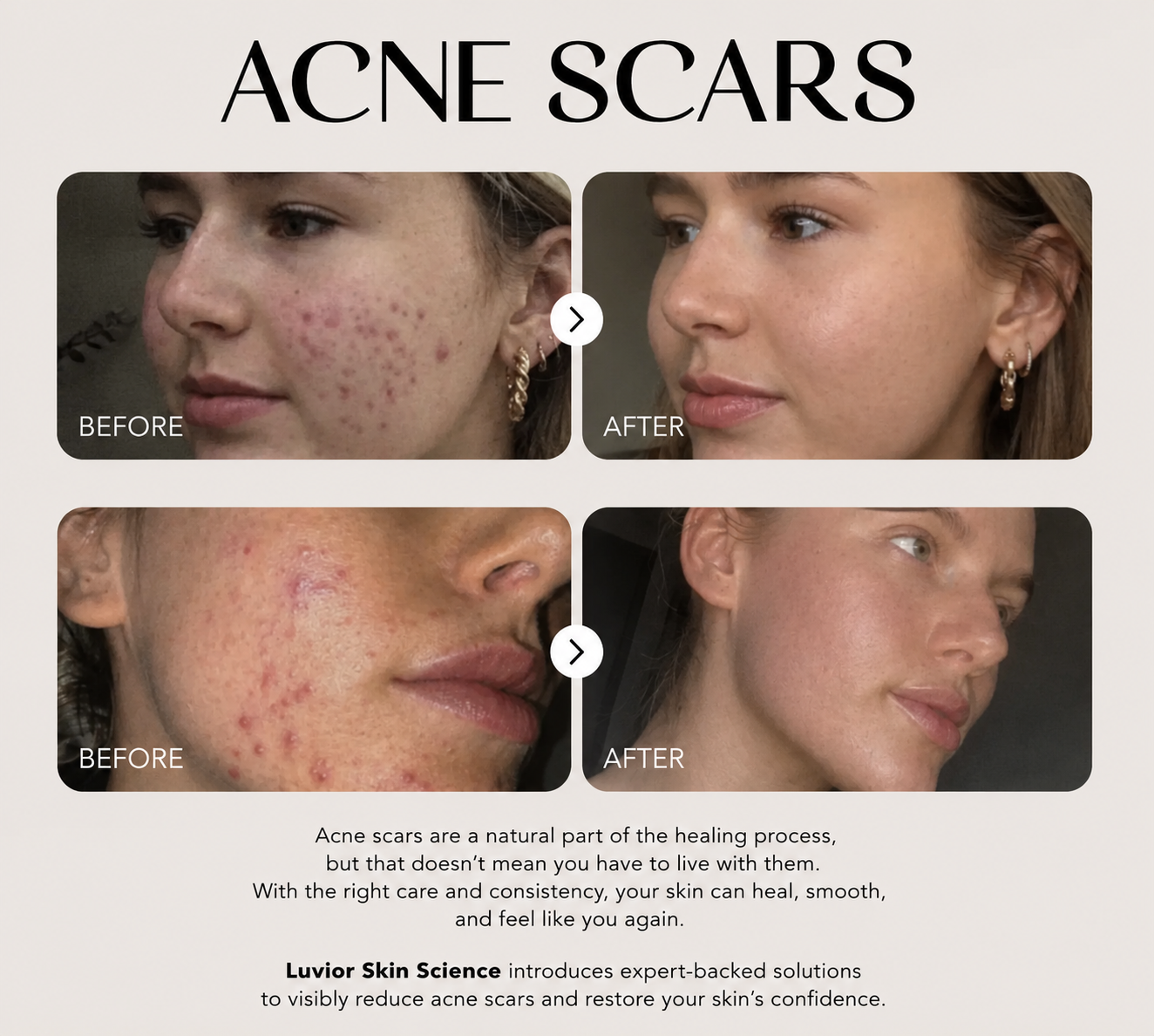 Luvior™ Dark Spot Corrector Serum