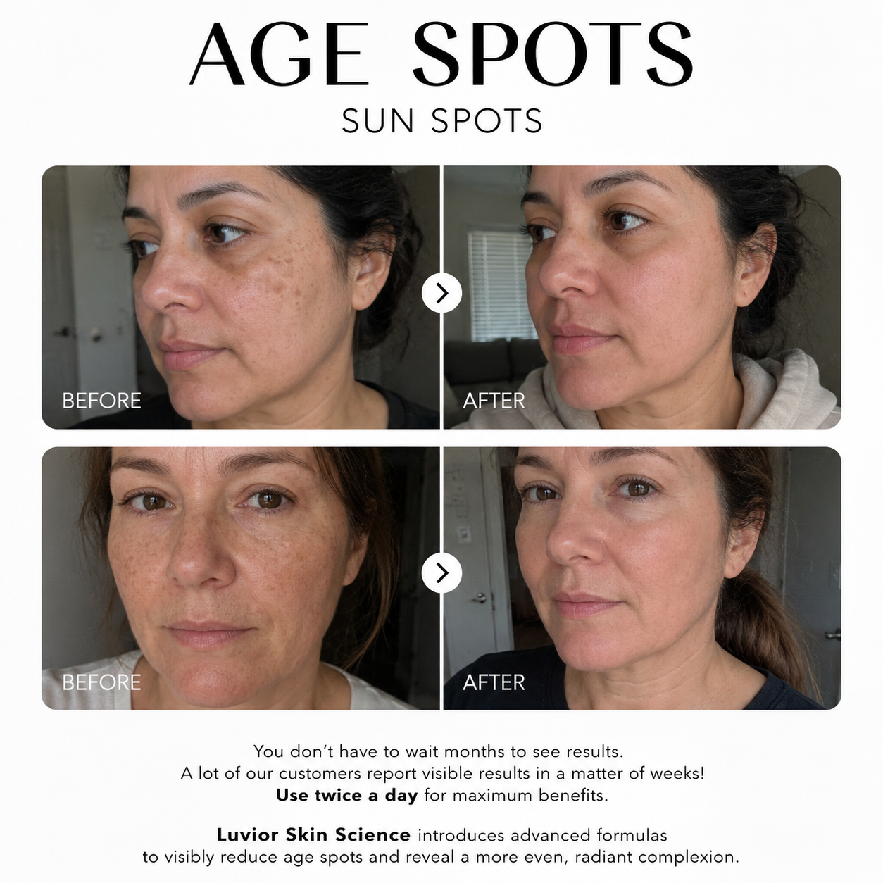 Luvior™ Dark Spot Corrector Serum
