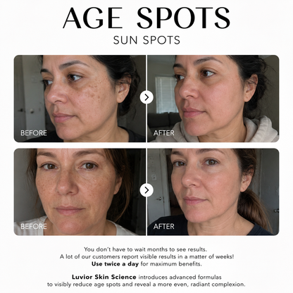 Luvior™ Dark Spot Corrector Serum