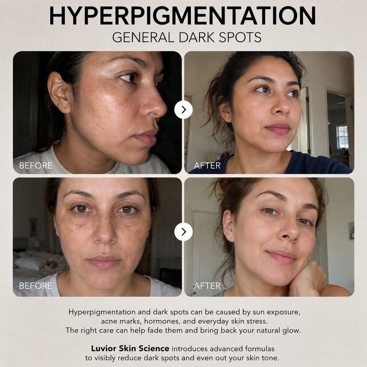 Luvior™ Dark Spot Corrector Serum