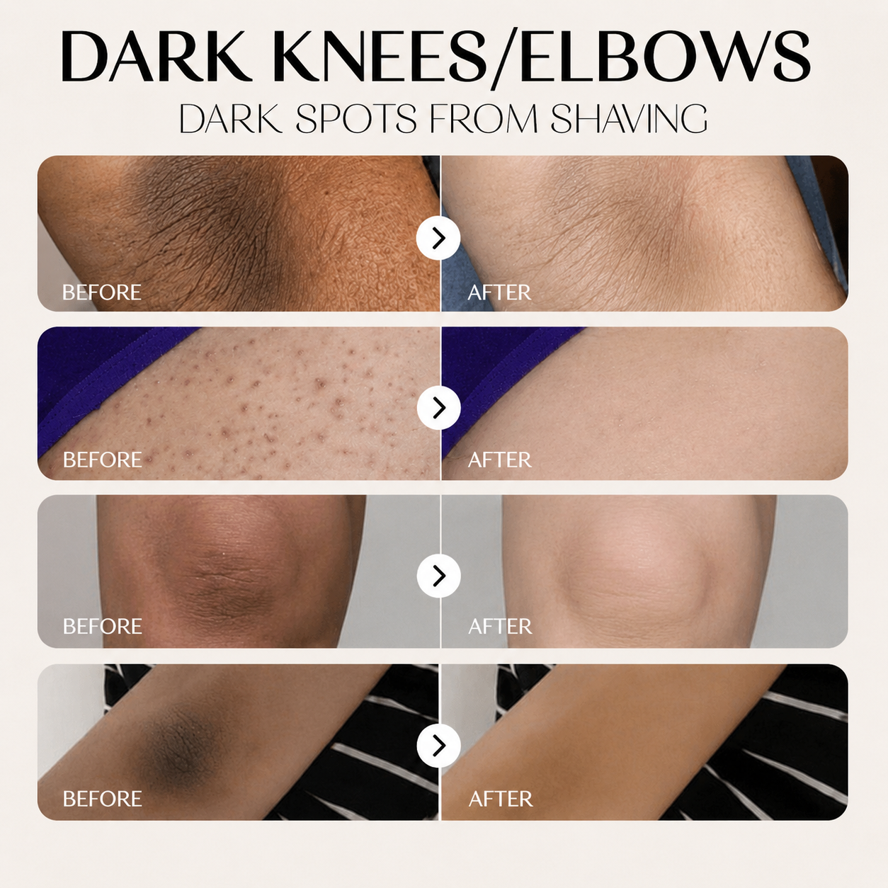 Luvior™ Dark Spot Corrector Serum
