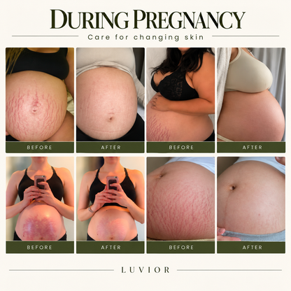 Luvior × Hoygi™ True Belly Serum